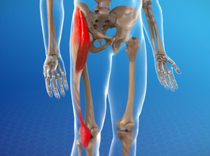 Iliotibial Band Syndrome (ITBS)