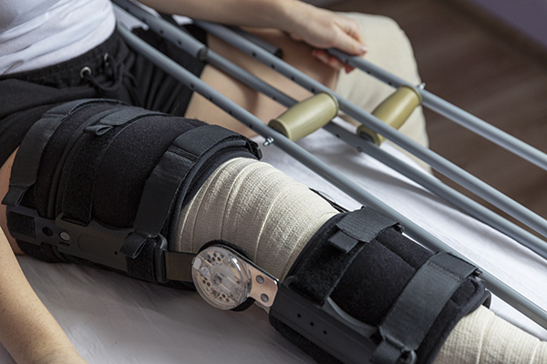 Tips for Recovering Faster from a Knee Replacement Surgery