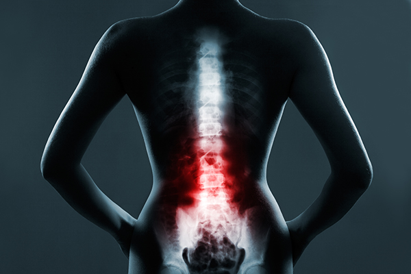 SPINE XRAY